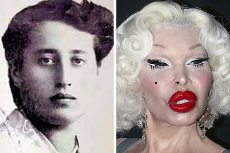 A picture of Amanda Lepore  before (left) and after (right).